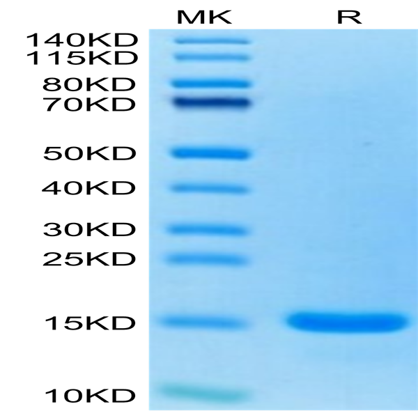 Human CCL7/MCP3 Protein (CCL-HE007)
