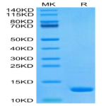 Human CCL8 Protein (CCL-HE108)
