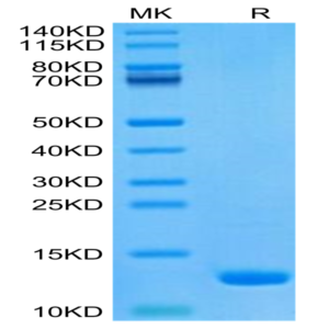 Human CCL8 Protein (CCL-HE108)