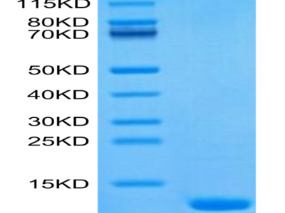 Human CCL8 Protein (CCL-HE108)