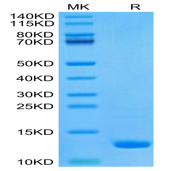 Human CCL8 Protein (CCL-HE108) Human CCL8 Protein (CCL-HE108)