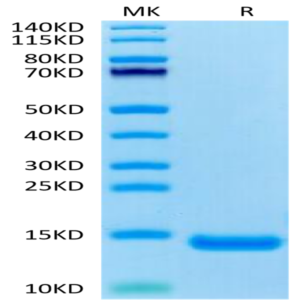 Human CCL11 Protein (CCL-HE111)