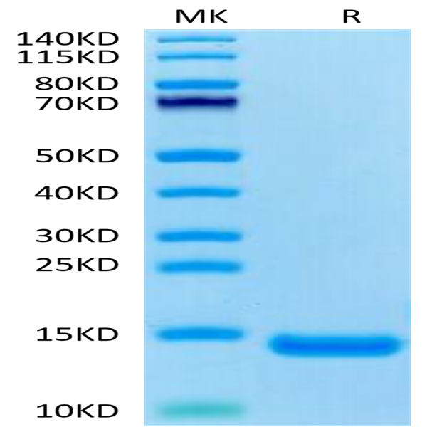 Human CCL11 Protein (CCL-HE111)