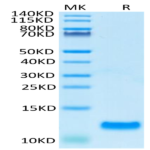 Human CCL20 Protein (CCL-HE120)