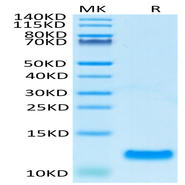 Human CCL20 Protein (CCL-HE120) Human CCL20 Protein (CCL-HE120)