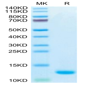 Biotinylated Human CCL5 Protein (CCL-HE405B)