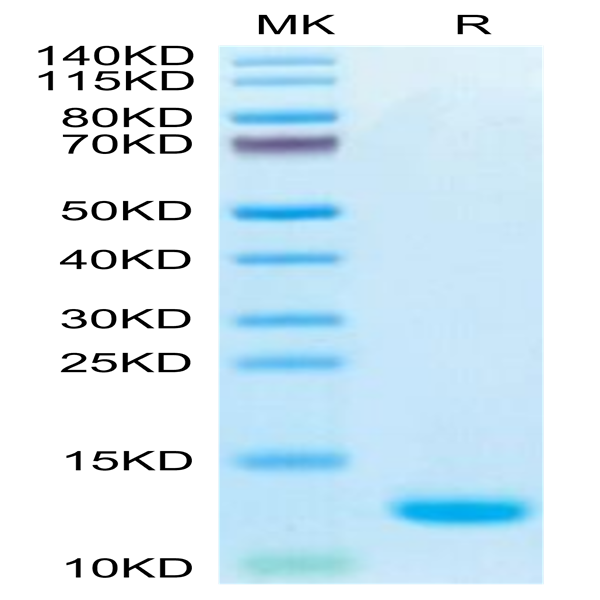 Biotinylated Human CCL5 Protein (CCL-HE405B)