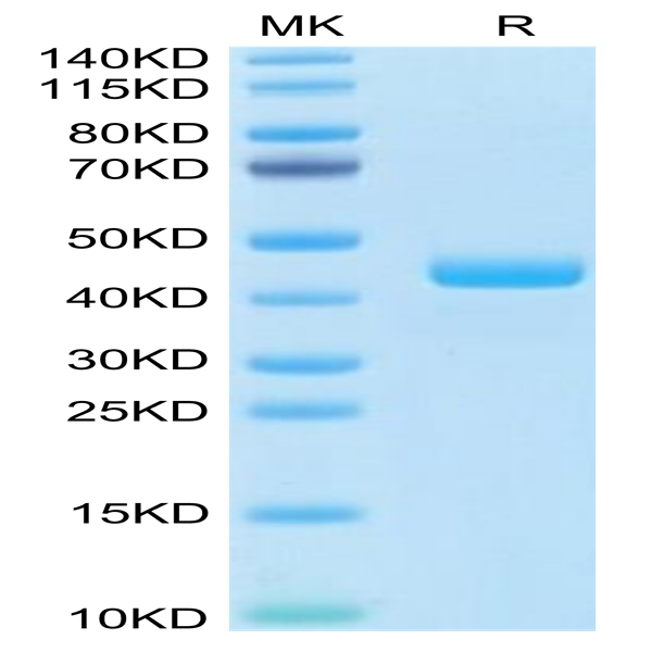 Human CCL24 Protein (CCL-HM224)