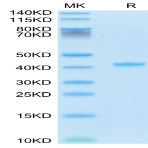 Mouse CCL5 Protein (CCL-MM205)