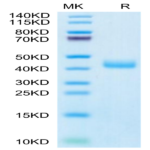 Human CCR8 Protein (CCR-HM208)