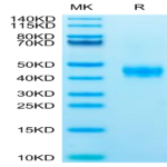 Human CCR8 Protein (CCR-HM308)