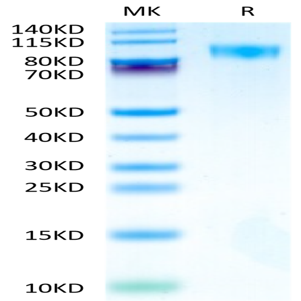 Cynomolgus/Rhesus macaque CD117 Protein (CD1-CM117)