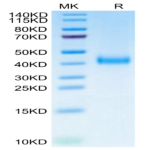 Biotinylated Cynomolgus IL-2 R beta/CD122 Protein (Primary Amine Labeling) (CD1-CM122B)