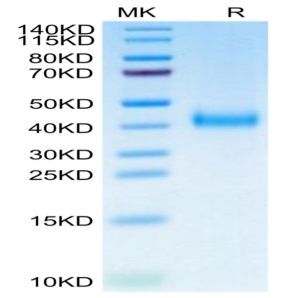 Biotinylated Cynomolgus IL-2 R beta/CD122 Protein (Primary Amine Labeling) (CD1-CM122B)