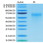 Cynomolgus IL-2 R gamma/CD132 Protein (CD1-CM132)