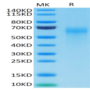 Cynomolgus IL-2 R gamma/CD132 Protein (CD1-CM132)
