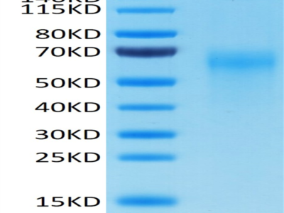 Cynomolgus IL-2 R gamma/CD132 Protein (CD1-CM132)