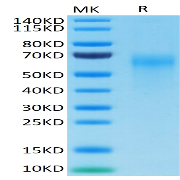 Cynomolgus IL-2 R gamma/CD132 Protein (CD1-CM132) Cynomolgus IL-2 R gamma/CD132 Protein (CD1-CM132)