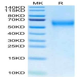 Biotinylated Cynomolgus IL-2 R gamma/CD132 Protein (Primary Amine Labeling) (CD1-CM132B)
