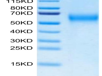 Biotinylated Cynomolgus IL-2 R gamma/CD132 Protein (Primary Amine Labeling) (CD1-CM132B)
