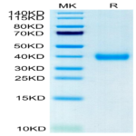 Cynomolgus CD161 Protein (CD1-CM461)