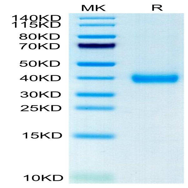 Cynomolgus CD161 Protein (CD1-CM461)
