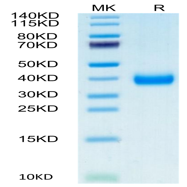 Biotinylated Cynomolgus CD161 Protein (CD1-CM461B)