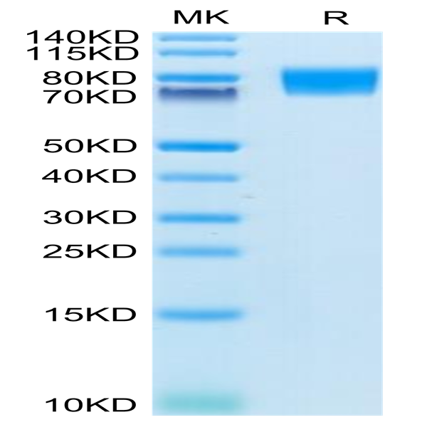 Human CD117 Protein (CD1-HM117)