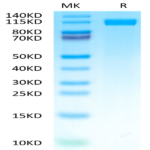 Human CD117 Protein (CD1-HM217)