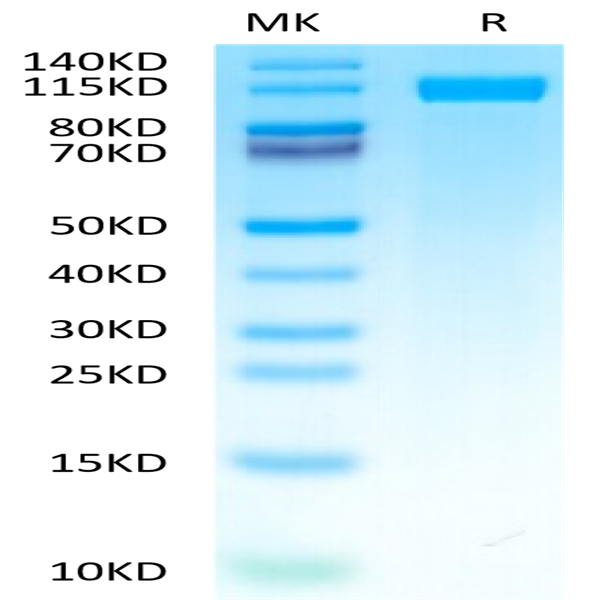 Human CD117 Protein (CD1-HM217)