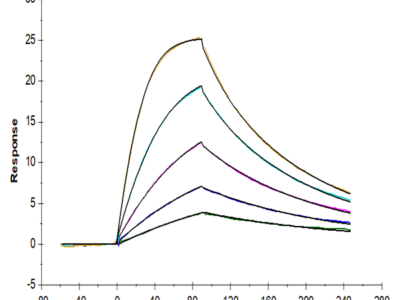 Human IL-2 R beta/CD122 Protein (CD1-HM222)