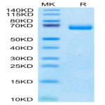 Human IL-2 R beta/CD122 Protein (CD1-HM222)