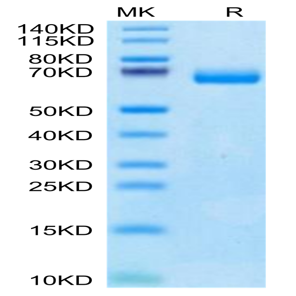 Human IL-2 R beta/CD122 Protein (CD1-HM222)