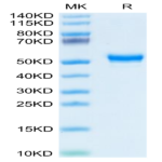 Human CD160 Protein (CD1-HM260)