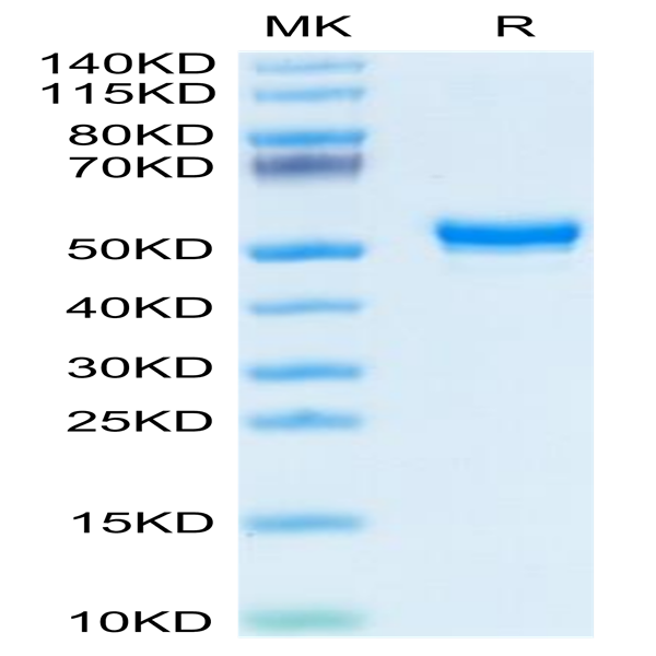 Human CD160 Protein (CD1-HM260)