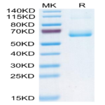 Human CD161 Protein (CD1-HM261)