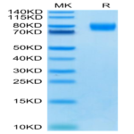 Human CD155/PVR Protein (CD1-HM355)