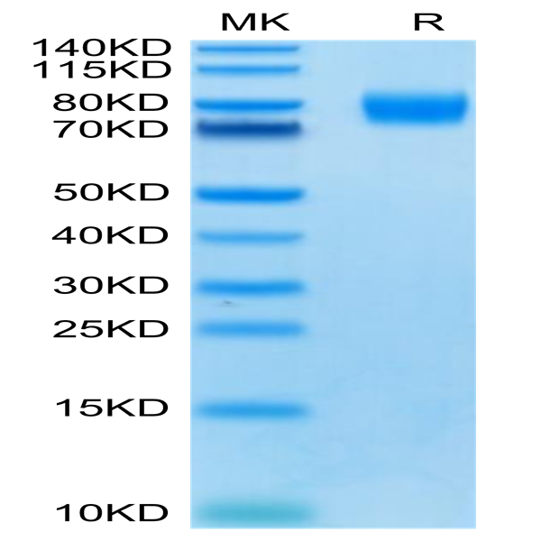 Human CD155/PVR Protein (CD1-HM355)