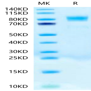 Biotinylated Human CD117 Protein (CD1-HM417B)