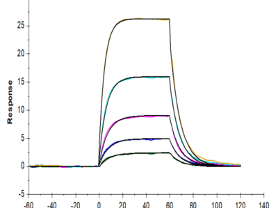 Human IL-2 R beta/CD122 Protein (CD1-HM422)