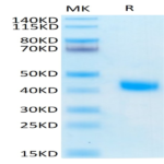Human IL-2 R beta/CD122 Protein (CD1-HM422)