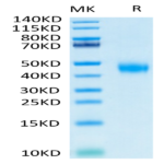 Biotinylated Human IL-2 R beta/CD122 Protein (CD1-HM422B)