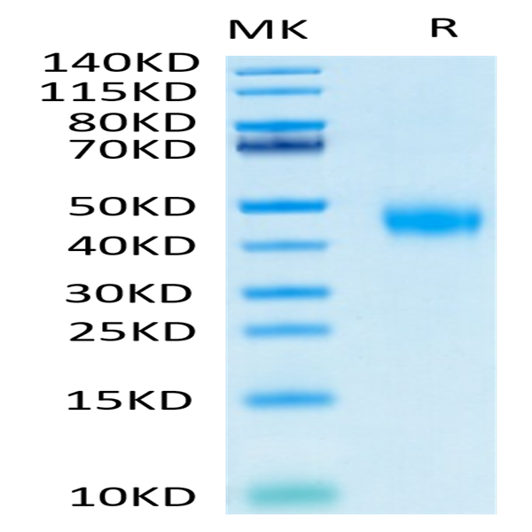 Biotinylated Human IL-2 R beta/CD122 Protein (CD1-HM422B)