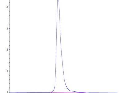 Human IL-2 R gamma/CD132 Protein (CD1-HM432)