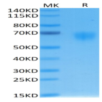 Human IL-2 R gamma/CD132 Protein (CD1-HM432)