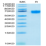 Biotinylated Human IL-2 R gamma/CD132 Protein (CD1-HM432B)