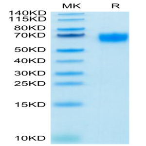 Biotinylated Human IL-2 R gamma/CD132 Protein (CD1-HM432B)