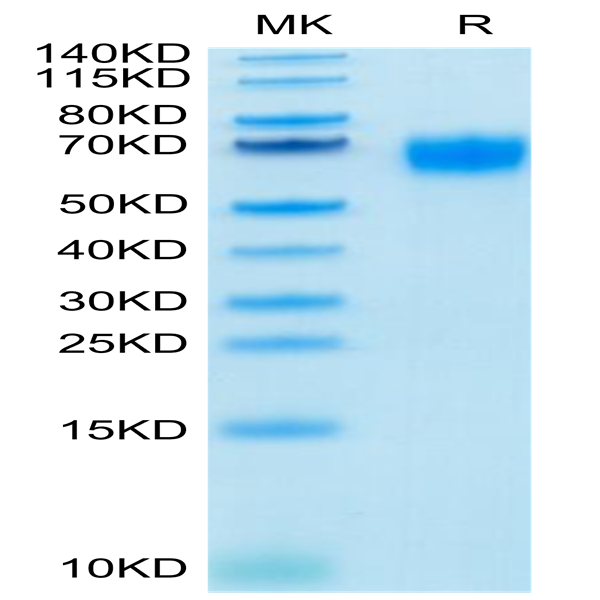 Biotinylated Human IL-2 R gamma/CD132 Protein (CD1-HM432B)