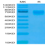 Human CD155/PVR Protein (CD1-HM455)