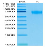 Biotinylated Human CD155/PVR Protein (CD1-HM455B)